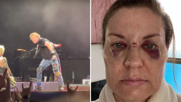 Axl Rose golpeó accidentalmente a una fanática